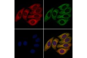 ABIN6258782 and ABIN6273627 staining Hela cells by IF/ICC. (FGF8 anticorps  (Internal Region))