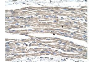 GPR161 antibody was used for immunohistochemistry at a concentration of 4-8 ug/ml to stain Skeletal muscle cells (arrows) in Human Muscle. (GPR161 anticorps  (Middle Region))