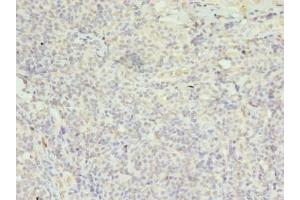 Immunohistochemistry of paraffin-embedded human tonsil tissue using ABIN7152974 at dilution of 1:100 (FPR1 anticorps  (AA 306-350))