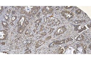 IHC analysis of ARG2 using anti-ARG2 antibody (ABIN7602662).