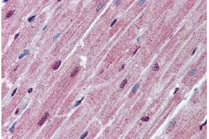 Human Heart: Formalin-Fixed, Paraffin-Embedded (FFPE)