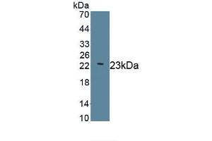 Detection of Recombinant LAMC2, Human using Monoclonal Antibody to Laminin Gamma 2 (LAMC2) (LAMC2 anticorps  (AA 28-196))