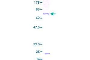 Image no. 1 for Translocase of Inner Mitochondrial Membrane 13 Homolog (TIMM13) (AA 1-95) protein (GST tag) (ABIN1322765)