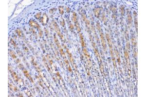 IHC analysis of TFF2 using anti-TFF2 antibody .
