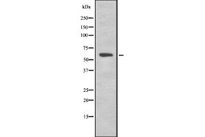 Western blot analysis of K2C1B expression in HEK293 cells ,The lane on the left is treated with the antigen-specific peptide. (Keratin 77 anticorps  (Internal Region))