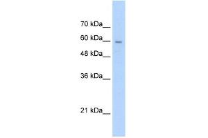 WB Suggested Anti-SLC22A1 Antibody Titration:  2.