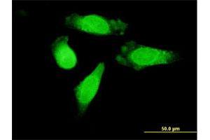 Immunofluorescence of purified MaxPab antibody to RANGAP1 on HeLa cell.