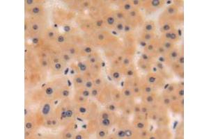 IHC-P analysis of liver tissue, with DAB staining. (C3 anticorps  (AA 965-1303))