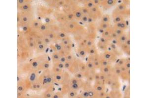 IHC-P analysis of liver tissue, with DAB staining.