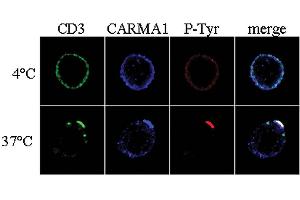 Immunocytochemistry analysis of CARMA1 using anti-CARMA1, pAb (AL220) . (CARD11 anticorps  (N-Term))