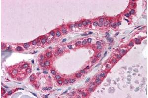 Human Thyroid: Formalin-Fixed, Paraffin-Embedded (FFPE) (WDR35 anticorps  (N-Term))