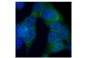Immunofluorescence (IF) image for anti-DEAD (Asp-Glu-Ala-Asp) Box Polypeptide 1 (DDX1) antibody (ABIN2664923) (DDX1 anticorps)