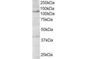 Image no. 1 for anti-Hermansky-Pudlak Syndrome 3 (HPS3) (C-Term) antibody (ABIN374450) (HPS3 anticorps  (C-Term))