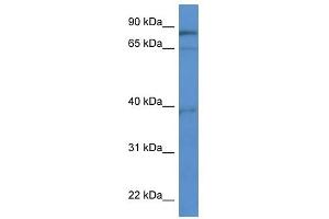 Western Blot showing ZCCHC7 antibody used at a concentration of 1-2 ug/ml to detect its target protein. (ZCCHC7 anticorps  (C-Term))