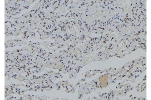 ABIN6279399 at 1/100 staining Human lung tissue by IHC-P. (PJA1 anticorps  (Internal Region))