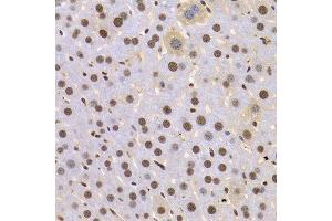 Immunohistochemistry of paraffin-embedded Mouse liver using HMGB1 antibody at dilution of 1:100 (x400 lens). (HMGB1 anticorps  (AA 100-200))