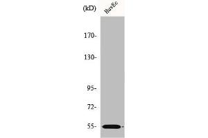 Western Blot analysis of HuvEc cells using ER81 Polyclonal Antibody (ETV1 anticorps  (N-Term))