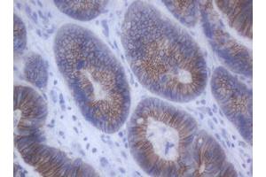 Image no. 3 for anti-Cadherin 1, Type 1, E-Cadherin (Epithelial) (CDH1) antibody (ABIN1497942)