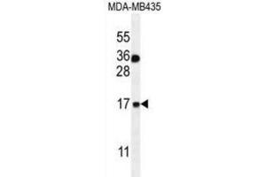 Western Blotting (WB) image for anti-S100 Calcium Binding Protein A1 (S100A1) antibody (ABIN2996370) (S100A1 anticorps)