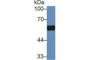 Detection of PAP in Human Urine using Polyclonal Antibody to Prostatic Acid Phosphatase (PAP) (ACPP anticorps  (AA 56-215))