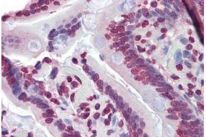 Human Small Intestine (formalin-fixed, paraffin-embedded) stained with NR1H3 antibody ABIN462212 followed by biotinylated goat anti-rabbit IgG secondary antibody ABIN481713, alkaline phosphatase-streptavidin and chromogen.