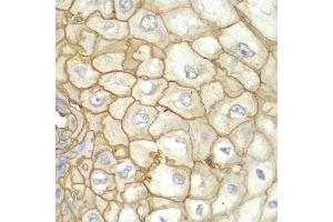 Immunohistochemistry of paraffin-embedded human esophagus using HLA-A antibody.
