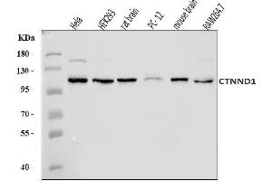 Western blot analysis of delta 1 Catenin/CAS/CTNND1 using anti-delta 1 Catenin/CAS/CTNND1 antibody (ABIN7602221). (CTNND1 anticorps  (AA 64-930))