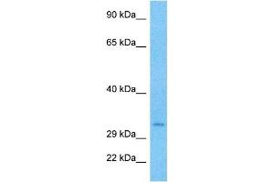 Host:  Rabbit  Target Name:  GSC  Sample Type:  786-0 Whole Cell lysates  Antibody Dilution:  0.