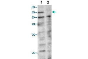 Western blot analysis of rad22 in yeast whole cell extracts. (Rad22 anticorps)