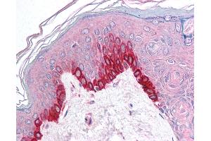 Anti-TRIM9 antibody IHC of human skin.