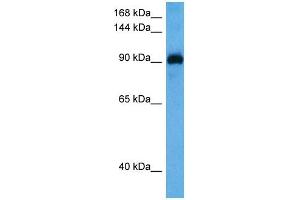 Host:  Rabbit  Target Name:  MYOCD  Sample Tissue:  Mouse Spleen  Antibody Dilution:  1ug/ml (Myocardin anticorps  (N-Term))