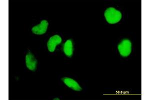 Immunofluorescence of monoclonal antibody to IRF2 on HeLa cell. (IRF2 anticorps  (AA 216-315))