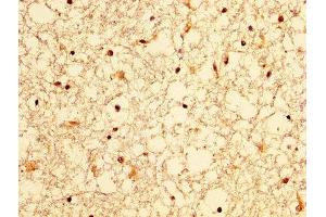 IHC image of ABIN7156316 diluted at 1:300 and staining in paraffin-embedded human brain tissue performed on a Leica BondTM system. (OCRL anticorps  (AA 121-271))