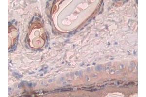 Detection of PFKP in Rat Skin Tissue using Polyclonal Antibody to Phosphofructokinase, Platelet (PFKP)