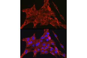 Immunofluorescence analysis of PC-12 cells using D Rabbit pAb (ABIN6134076, ABIN6139403, ABIN6139404 and ABIN6224222) at dilution of 1:250 (40x lens). (DAPK2 anticorps  (C-Term))
