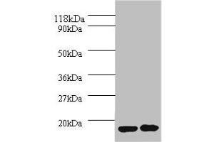 Western blot All lanes: IL1RN antibody at 2 μg/mL Lane 1: EC109 whole cell lysate Lane 2: 293T whole cell lysate Secondary Goat polyclonal to rabbit IgG at 1/10000 dilution Predicted band size: 21, 18, 20, 17 kDa Observed band size: 17 kDa