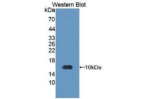 Western blot analysis of the recombinant protein. (PIM1 anticorps  (AA 122-261))