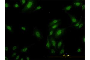Immunofluorescence of monoclonal antibody to RPL9 on HeLa cell.