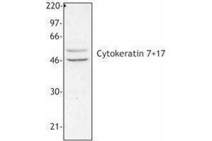 Western Blotting (WB) image for anti-Keratin 7/17 (KRT7/17) antibody (ABIN2664920)