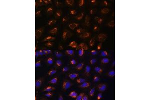 Immunofluorescence analysis of U2OS cells using MEK2 antibody (ABIN7268640) at dilution of 1:100.