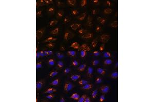 Immunofluorescence analysis of U2OS cells using MEK2 antibody (ABIN7268640) at dilution of 1:100. (MEK2 anticorps  (AA 1-100))