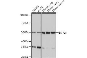 Western blot analysis of extracts of various cell lines, using BMP15 Rabbit mAb (ABIN7265896) at 1:1000 dilution. (BMP15 anticorps)