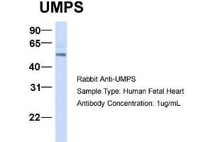 Host:  Rabbit  Target Name:  UMPS  Sample Type:  Human Fetal Heart  Antibody Dilution:  1. (UMPS anticorps  (C-Term))