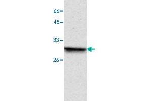 Western blot analysis of MCF-7 whole cell lystae with PPP4C monoclonal antibody, clone 2  at 1:1000 dilution. (PPP4C anticorps)
