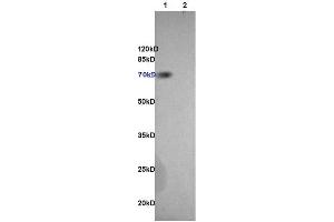L1 rat brain, L2 rat heart lysates probed (ABIN707561) at 1:200 in 4 °C.