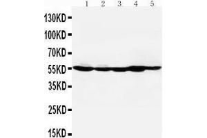 Anti-HDAC2 antibody, Western blotting Lane 1: MM453 Cell Lysate Lane 2: MCF-7 Cell Lysate Lane 3: HELA Cell Lysate Lane 4: SMMC Cell Lysate Lane 5: COLO320 Cell Lysate (HDAC2 anticorps  (C-Term))