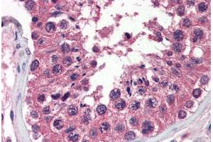 Human Testis (formalin-fixed, paraffin-embedded) stained with UNG antibody ABIN364332 at 10 ug/ml followed by biotinylated anti-mouse IgG secondary antibody ABIN481714, alkaline phosphatase-streptavidin and chromogen. (UNG anticorps  (AA 1-313))