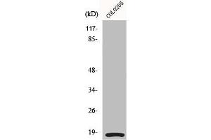 Western Blot analysis of COLO205 cells using MRLC2 Polyclonal Antibody (MYL12A anticorps)