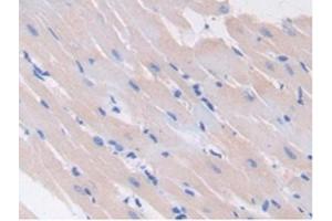 Detection of GAD2 in Rat Heart Tissue using Polyclonal Antibody to Glutamate Decarboxylase 2 (GAD2)