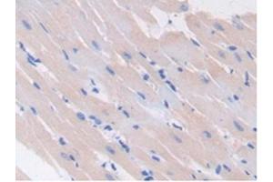 Detection of GAD2 in Rat Heart Tissue using Polyclonal Antibody to Glutamate Decarboxylase 2 (GAD2) (GAD65 anticorps  (AA 188-374))